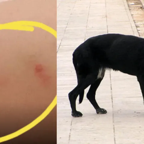 Mostar: Čopor pasa lutalica napao i ozlijedio studenticu