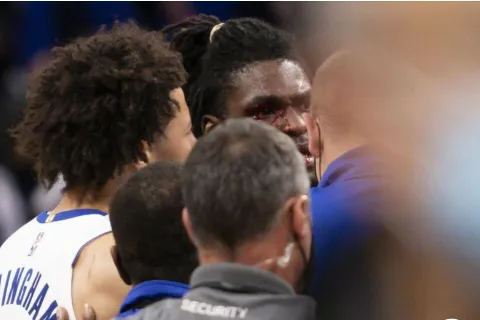 LeBron laktom udario protivnika, krv mu prekrila lice