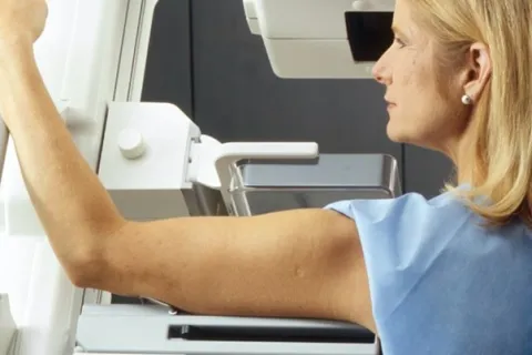 Otkrivanje raka dojke