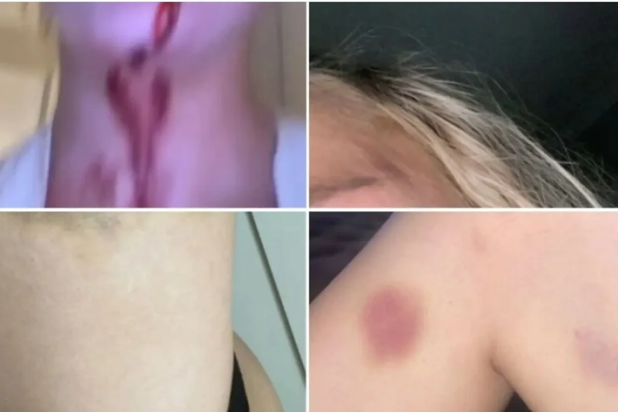 Igrač Manchester Uniteda zvjerski pretukao biv&scaron;u djevojku?