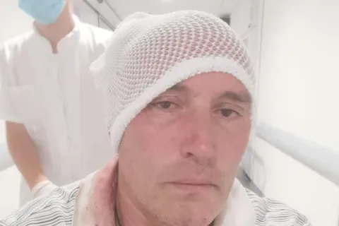 Pretučeni navijač Partizana