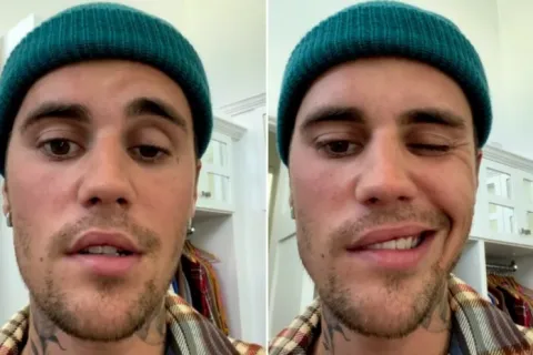 Justin Bieber