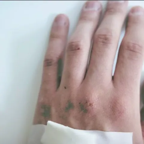 Ilustrativna fotografija