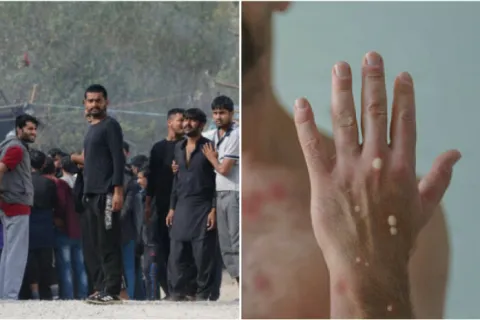 Blažuj: Migrant ima majmunske boginje