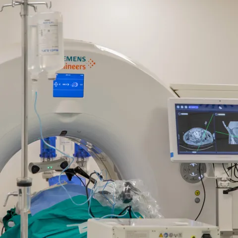 Zagreb, 24.03.2023 - Po prvi puta u Hrvatskoj u KBC-u Sestre milosrdnice izvedeni su zahvati ablacije i biopsije tumora na onkolo&scaron;kim pacijentima pomoću robotske ruke, izvijestili su u petak iz tog KBC-a