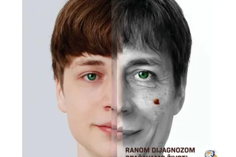 U sklopu kampanje Euromelanoma 2025 – besplatni dermatološki pregledi u Mostaru
