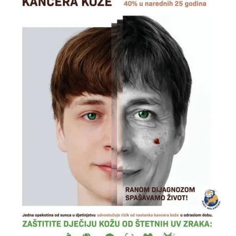 U sklopu kampanje Euromelanoma 2025 – besplatni dermatološki pregledi u Mostaru