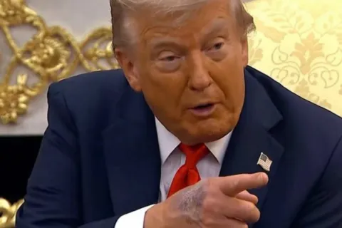 Velika masnica na Trumpovoj ruci