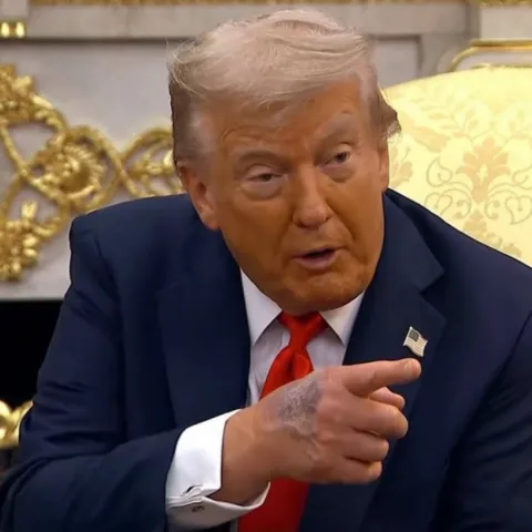 Velika masnica na Trumpovoj ruci